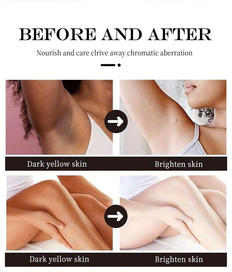 MAYCHEER® Whitening Cream to Remove Body Darkening